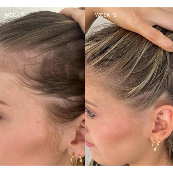 Vida Glow Advanced Repair Hairology 
