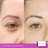 Vida Glow Collagen Liquid Advance Mixed Berries
