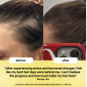 Bondi Boost HG Lock Drops Anti-Shedding Scalp & Hair Serum